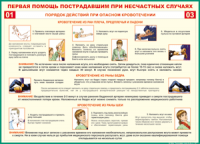 Таблица "Порядок действий при опасном кровотечении" (100х140 сантиметров, винил) - fgospostavki.ru - Хабаровск
